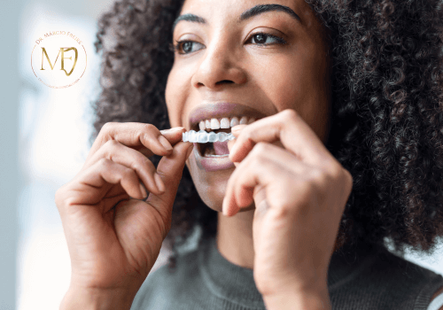 invisalign-img-2